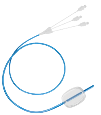 Advancing Stricture Management – Our Three-Stage Balloon Dilator in Endoscopi...
