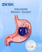 Adjustable Intragastric Balloon Weight Loss Endoscopic Gastric Balloon